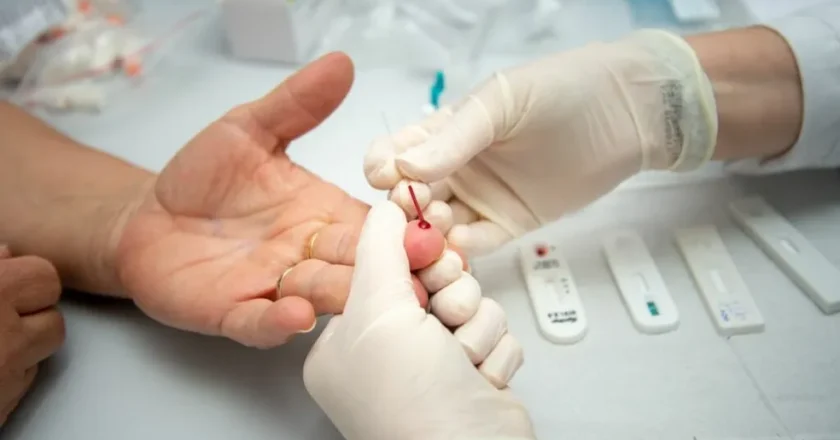 Aumento alarmante de HIV entre jovens levanta preocupações sobre excessos na vida moderna